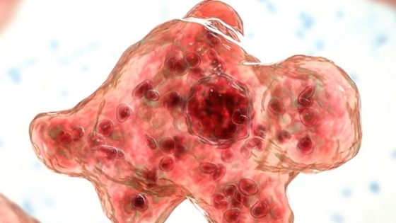 Image credit: North Carolina teen dies after contracting ‘brain-eating amoeba’