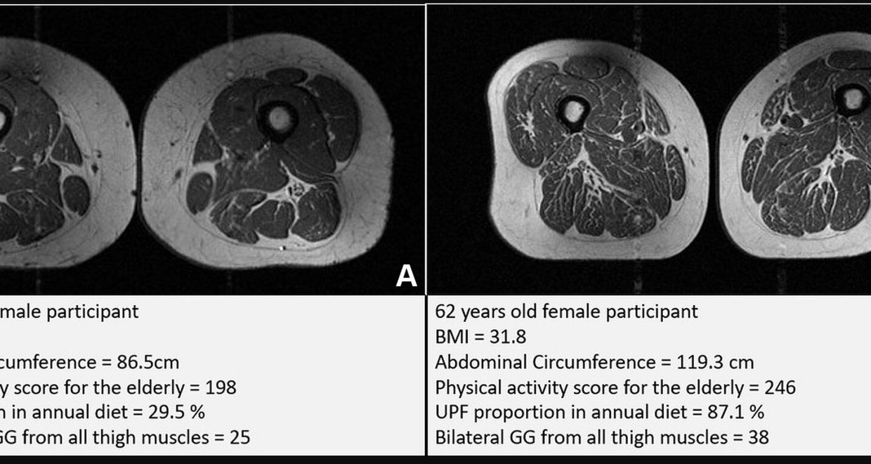 Image credit: People who consume ultra-processed foods have worse muscle health, study suggests