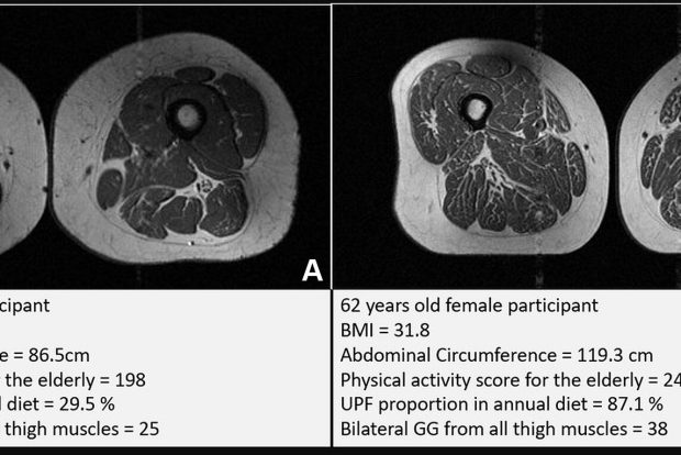 Study Links Ultra-Processed Foods to Poorer Muscle Health