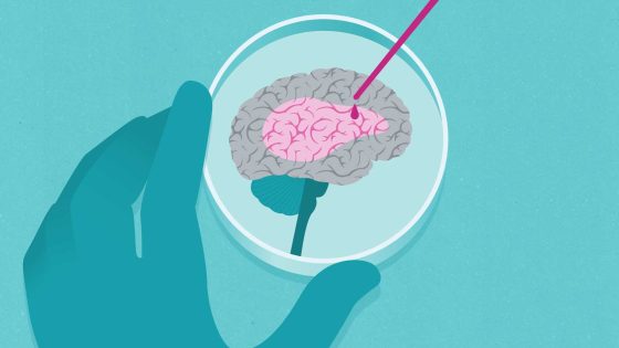Study Finds Single Psilocybin Dose Can Alter Brain Anatomy