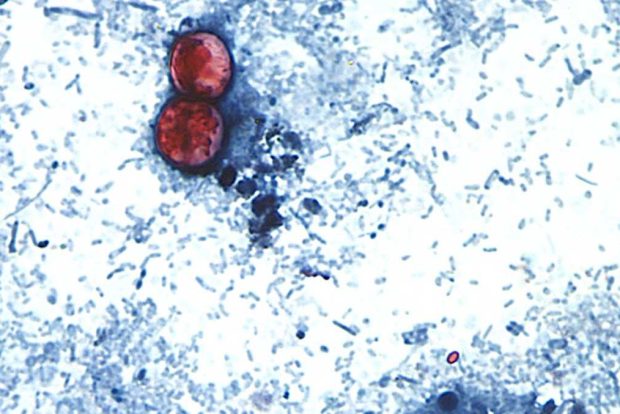 Two Cases of Cyclosporiasis Confirmed in New Hampshire, Health Officials Report