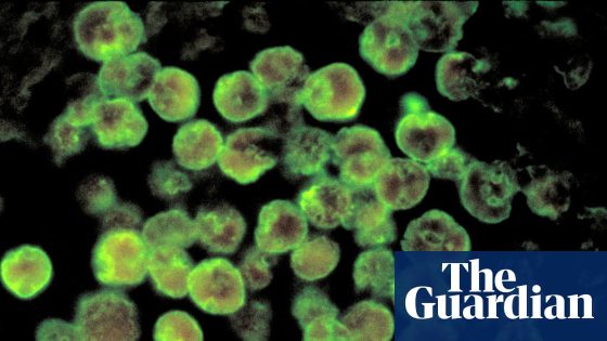 North Carolina Teenager Dies from Brain-Eating Amoeba Infection