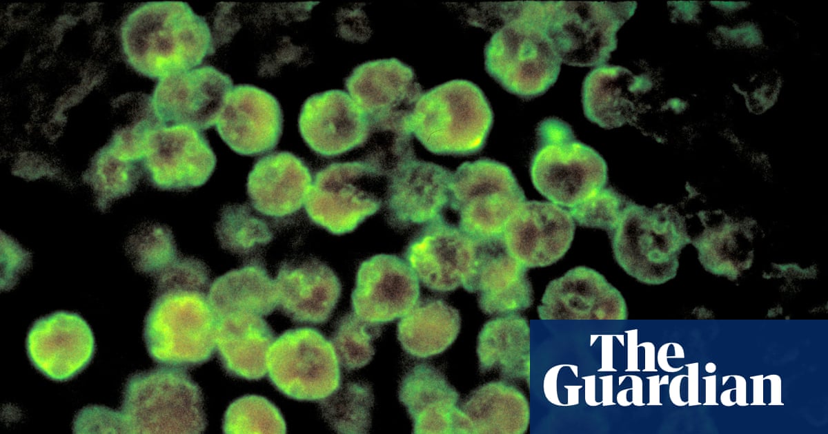 Image credit: North Carolina teenager dies from rare infection caused by brain-eating amoeba | North Carolina | The Guardian / https://www.theguardian.com/profile/maya-yang